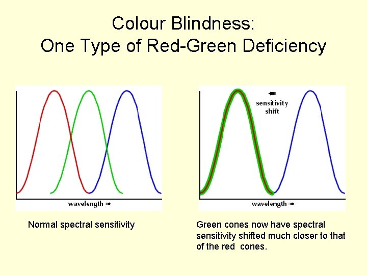 Colour Blindness: One Type of Red-Green Deficiency Normal spectral sensitivity Green cones now have