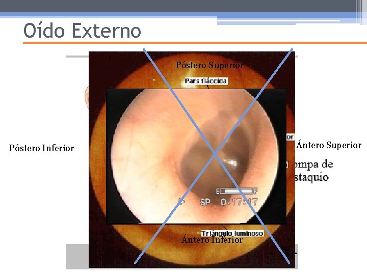 Oído Externo Póstero Superior Ántero Superior Póstero Inferior Ántero Inferior Pabellón Auricular 