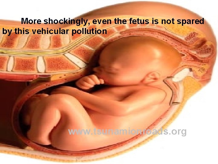 More shockingly, even the fetus is not spared by this vehicular pollution www. tsunamionroads. More shockingly, even the fetus is not spared by this vehicular pollution www. tsunamionroads.