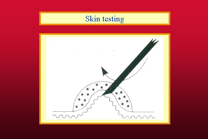 Skin testing 