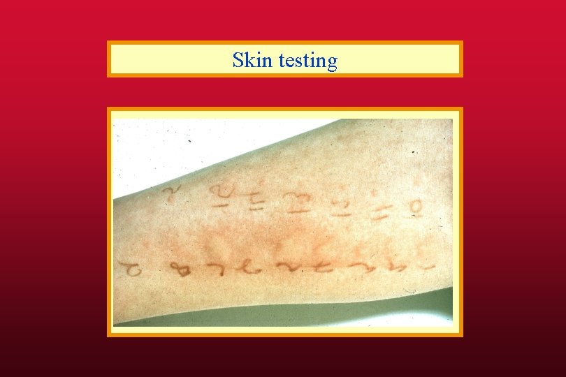 Skin testing 