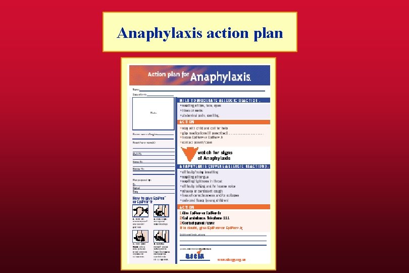 Anaphylaxis action plan 