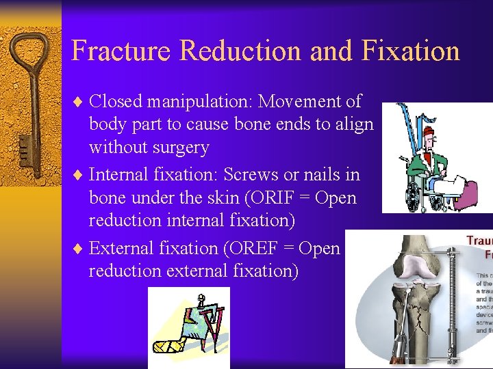 Fracture Reduction and Fixation ¨ Closed manipulation: Movement of body part to cause bone