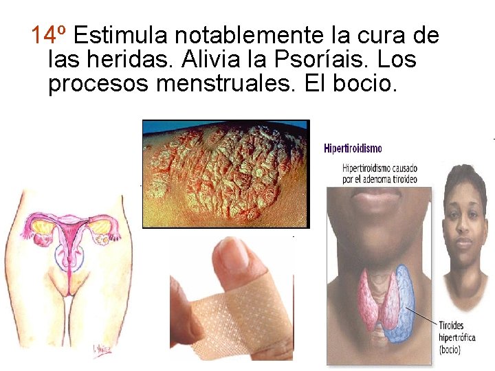 14º Estimula notablemente la cura de las heridas. Alivia la Psoríais. Los procesos menstruales.