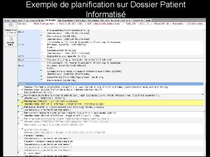 Exemple de planification sur Dossier Patient Informatisé 