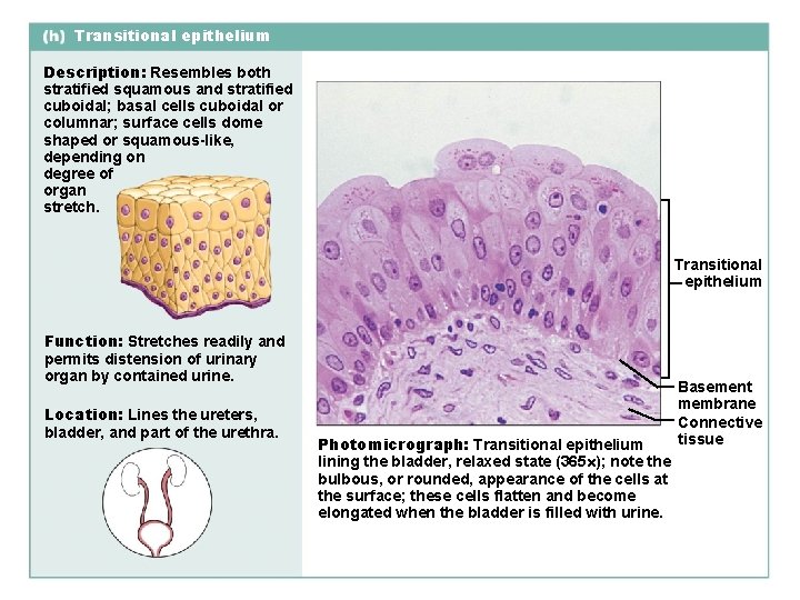 Transitional epithelium Description: Resembles both stratified squamous and stratified cuboidal; basal cells cuboidal or