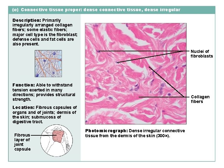 Connective tissue proper: dense connective tissue, dense irregular Description: Primarily irregularly arranged collagen fibers;