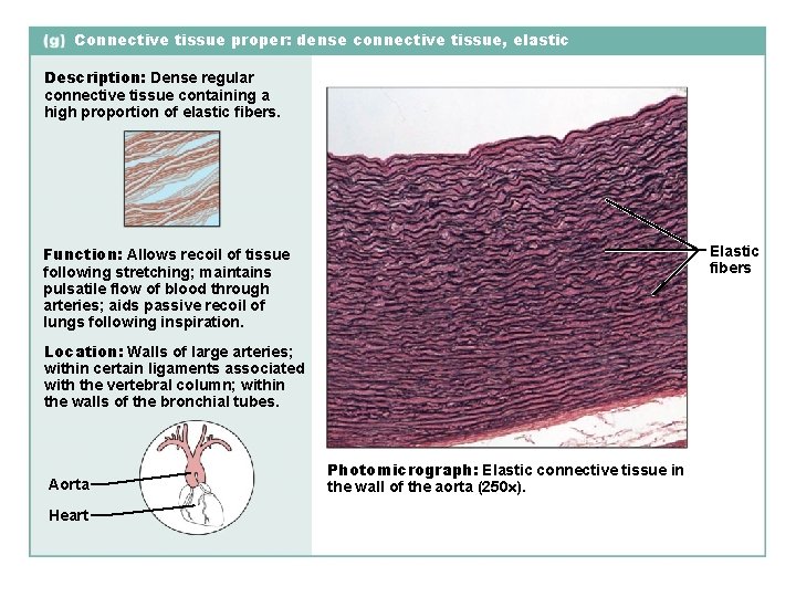 Connective tissue proper: dense connective tissue, elastic Description: Dense regular connective tissue containing a