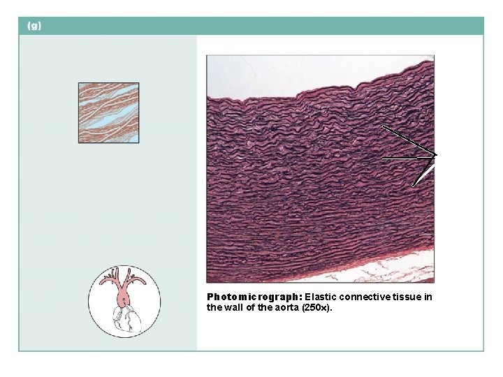 Photomicrograph: Elastic connective tissue in the wall of the aorta (250 ). 