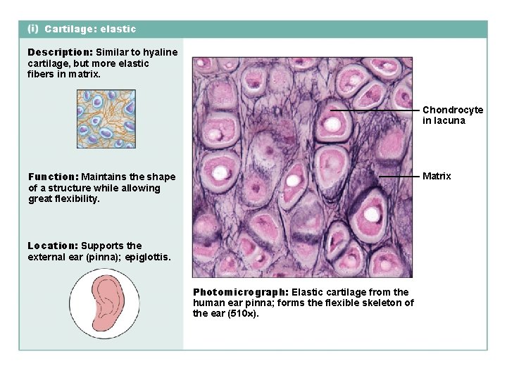 Cartilage: elastic Description: Similar to hyaline cartilage, but more elastic fibers in matrix. Chondrocyte