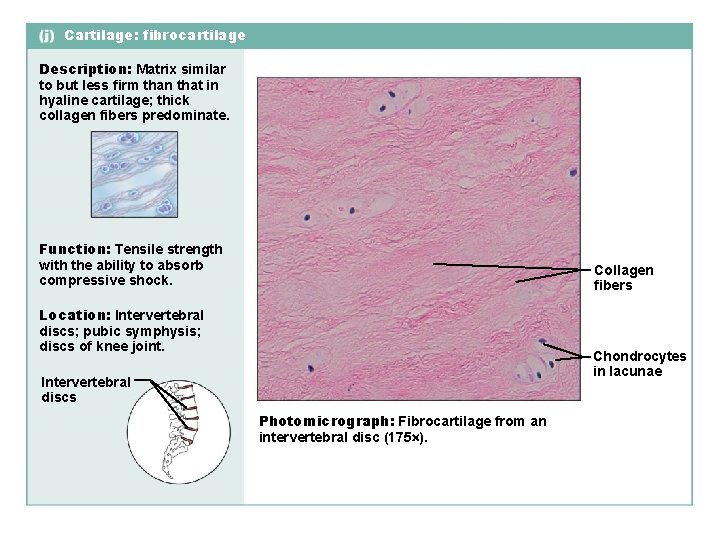 Cartilage: fibrocartilage Description: Matrix similar to but less firm than that in hyaline cartilage;