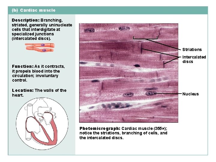 Cardiac muscle Description: Branching, striated, generally uninucleate cells that interdigitate at specialized junctions (intercalated