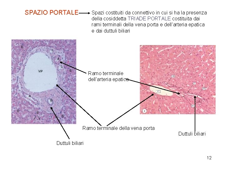 SPAZIO PORTALE Spazi costituiti da connettivo in cui si ha la presenza della cosiddetta SPAZIO PORTALE Spazi costituiti da connettivo in cui si ha la presenza della cosiddetta