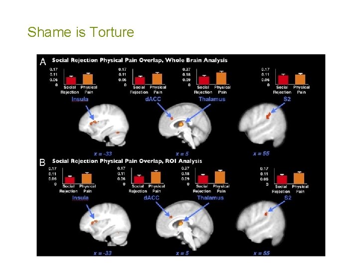 Shame is Torture 