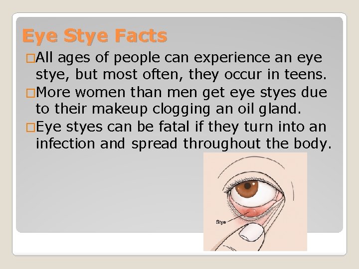 Eye Stye Facts �All ages of people can experience an eye stye, but most