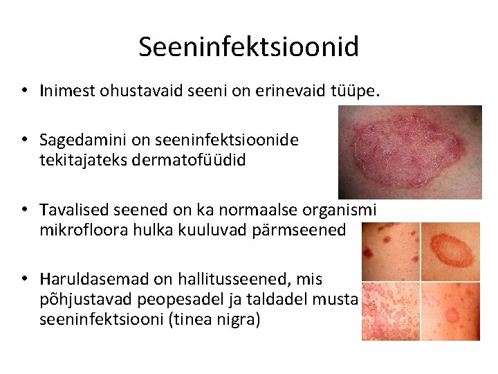 Seeninfektsioonid • Inimest ohustavaid seeni on erinevaid tüüpe. • Sagedamini on seeninfektsioonide tekitajateks dermatofüüdid