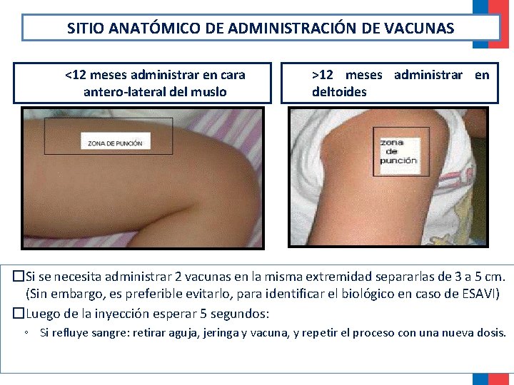 SITIO ANATÓMICO DE ADMINISTRACIÓN DE VACUNAS <12 meses administrar en cara antero-lateral del muslo SITIO ANATÓMICO DE ADMINISTRACIÓN DE VACUNAS <12 meses administrar en cara antero-lateral del muslo