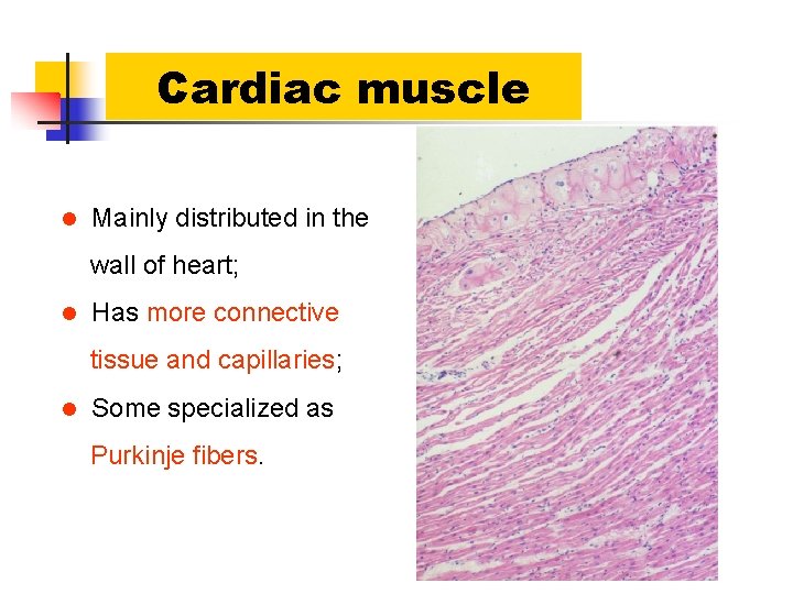 Cardiac muscle l Mainly distributed in the wall of heart; l Has more connective