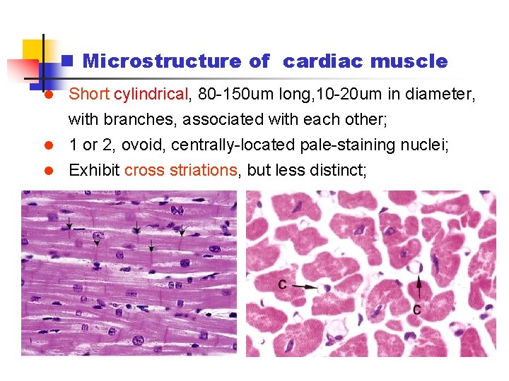 n Microstructure of cardiac muscle l Short cylindrical, 80 -150 um long, 10 -20