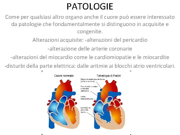 PATOLOGIE Come per qualsiasi altro organo anche il cuore può essere interessato da patologie