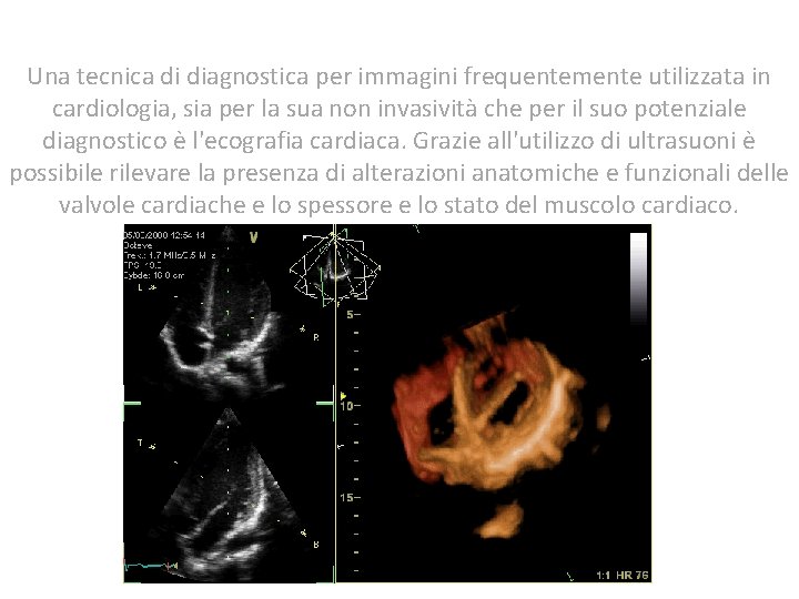 Una tecnica di diagnostica per immagini frequentemente utilizzata in cardiologia, sia per la sua