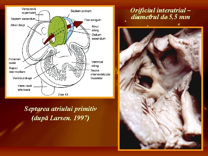 Orificiul interatrial – diametrul de 5, 5 mm Septarea atriului primitiv (după Larsen, 1997)