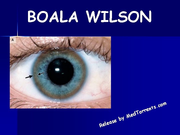 BOALA WILSON om c. s nt e r r To d e y M