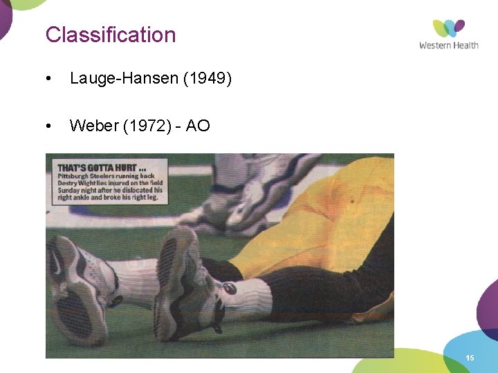 Classification • Lauge-Hansen (1949) • Weber (1972) - AO 15 