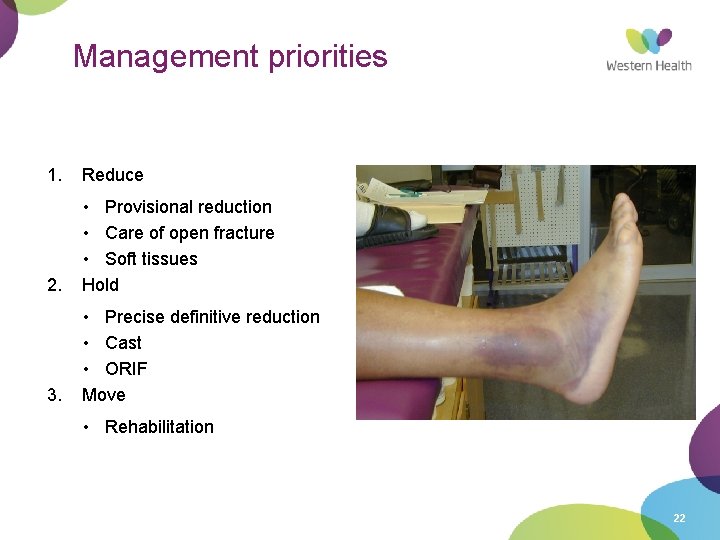 Management priorities 1. Reduce 2. • Provisional reduction • Care of open fracture •