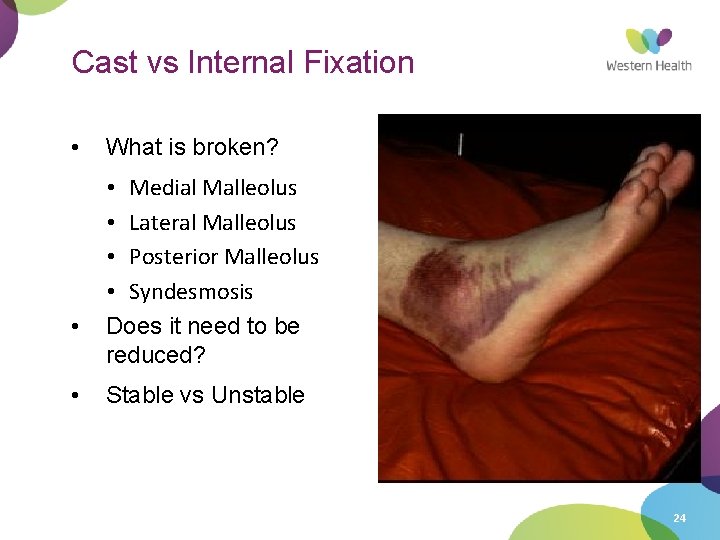 Cast vs Internal Fixation • • • What is broken? • Medial Malleolus •