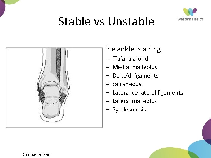 Stable vs Unstable • The ankle is a ring – – – – Source: