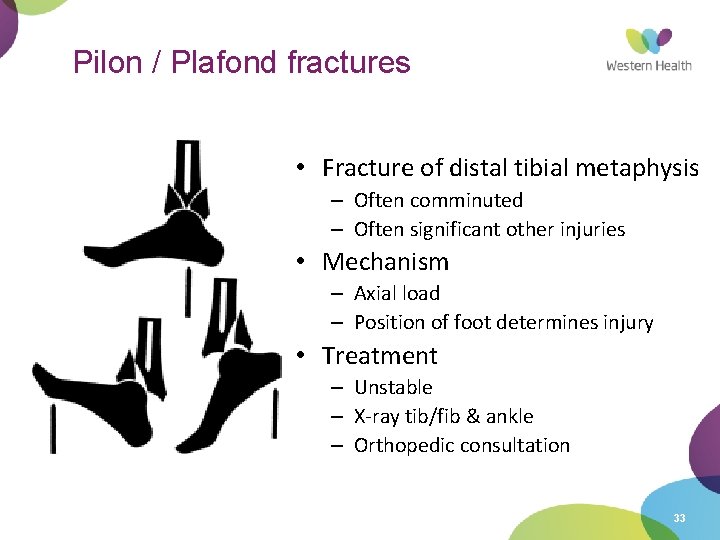 Pilon / Plafond fractures • Fracture of distal tibial metaphysis – Often comminuted –