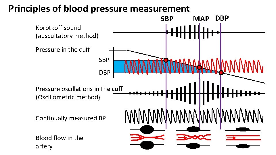 Principles of blood pressure measurement SBP Korotkoff sound (auscultatory method) Pressure in the cuff