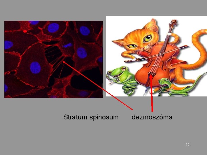 Stratum spinosum dezmoszóma 42 