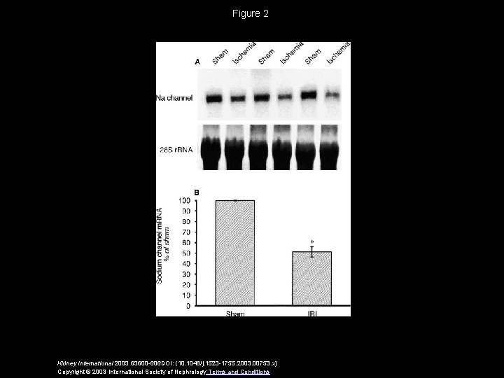 Figure 2 Kidney International 2003 63600 -606 DOI: (10. 1046/j. 1523 -1755. 2003. 00753.