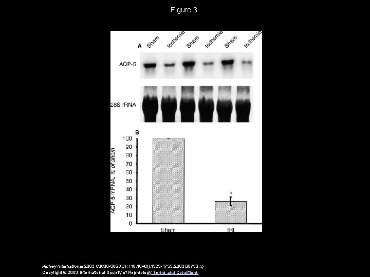 Figure 3 Kidney International 2003 63600 -606 DOI: (10. 1046/j. 1523 -1755. 2003. 00753.