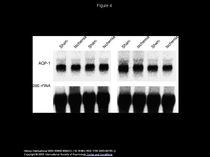 Figure 4 Kidney International 2003 63600 -606 DOI: (10. 1046/j. 1523 -1755. 2003. 00753.