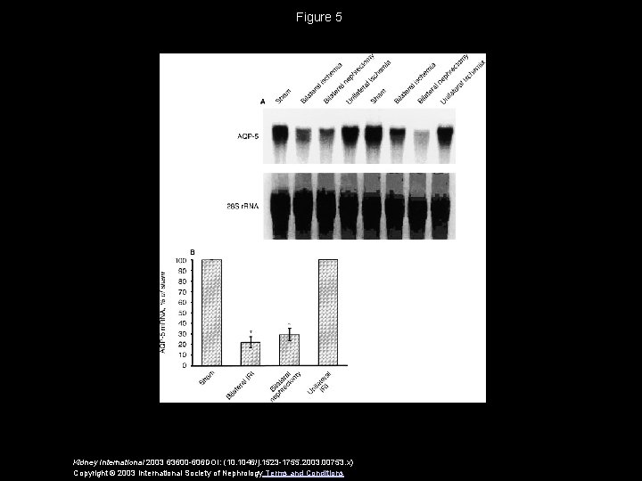 Figure 5 Kidney International 2003 63600 -606 DOI: (10. 1046/j. 1523 -1755. 2003. 00753.