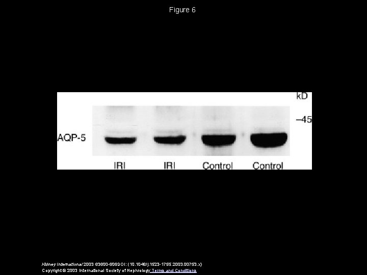 Figure 6 Kidney International 2003 63600 -606 DOI: (10. 1046/j. 1523 -1755. 2003. 00753.