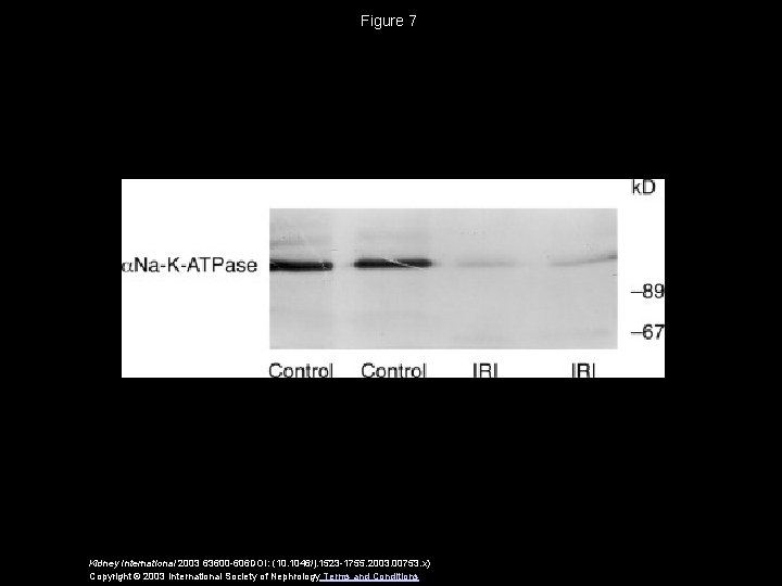 Figure 7 Kidney International 2003 63600 -606 DOI: (10. 1046/j. 1523 -1755. 2003. 00753.