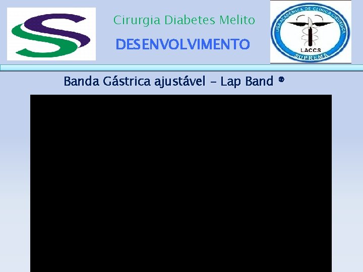 Cirurgia Diabetes Melito DESENVOLVIMENTO Banda Gástrica ajustável - Lap Band ® 