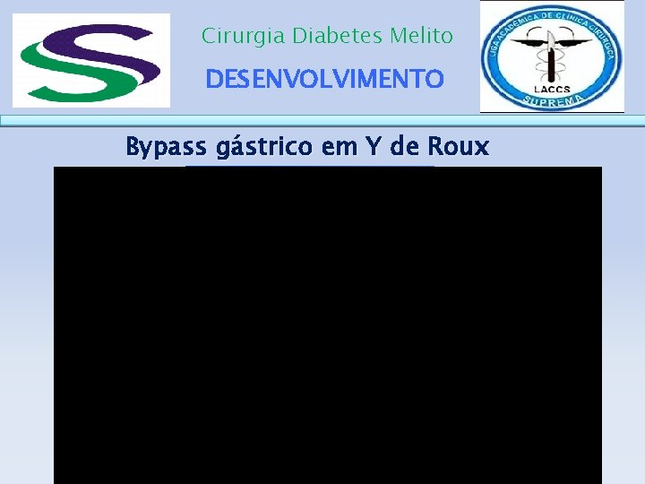 Cirurgia Diabetes Melito DESENVOLVIMENTO Bypass gástrico em Y de Roux 