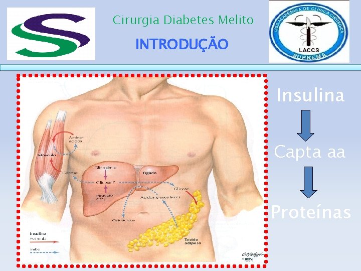 Cirurgia Diabetes Melito INTRODUÇÃO Insulina Capta aa Proteínas 