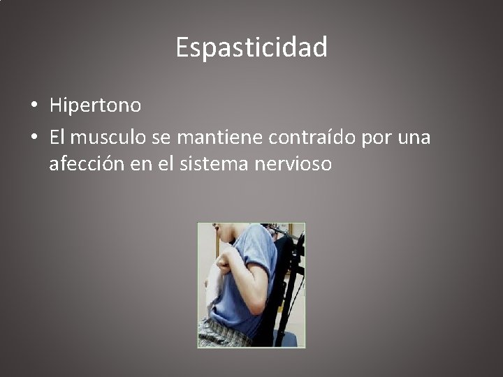 Espasticidad • Hipertono • El musculo se mantiene contraído por una afección en el