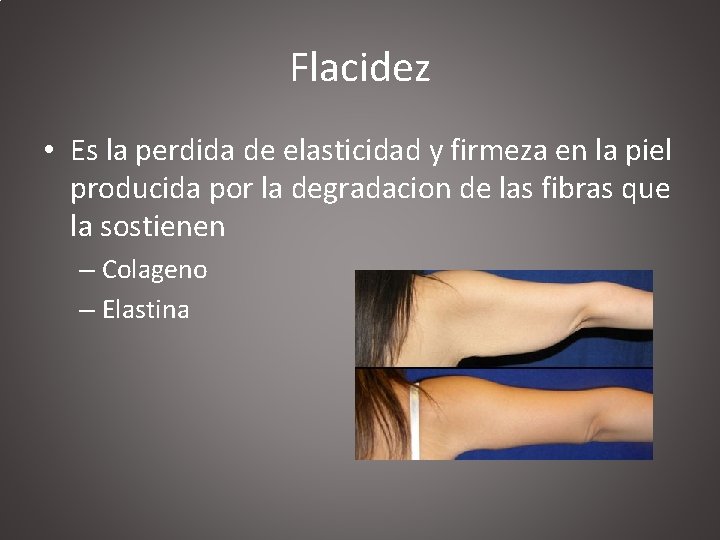 Flacidez • Es la perdida de elasticidad y firmeza en la piel producida por