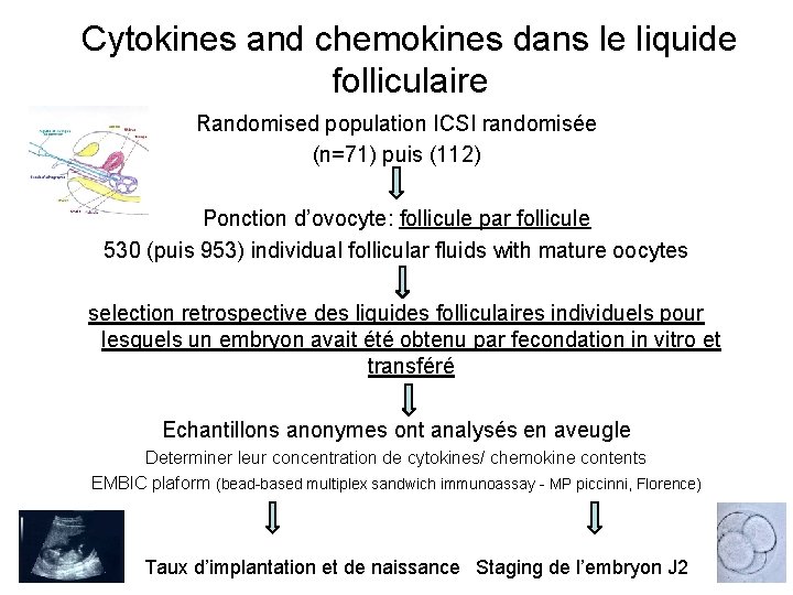 Cytokines and chemokines dans le liquide folliculaire Randomised population ICSI randomisée (n=71) puis (112)