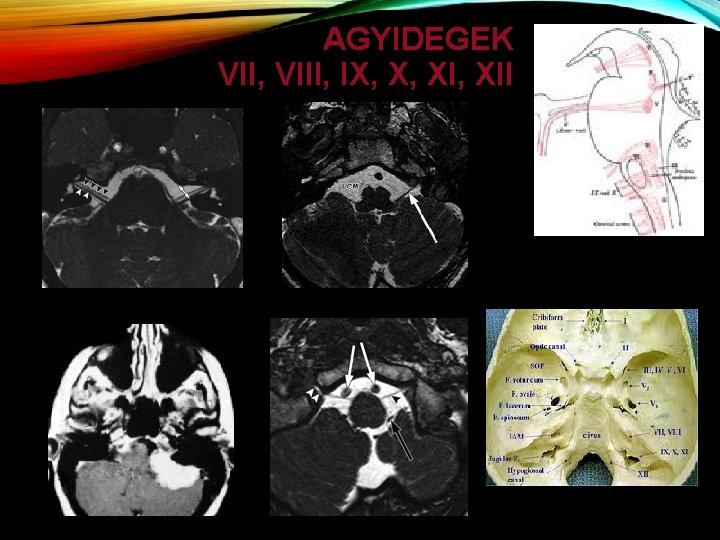 AGYIDEGEK VII, VIII, IX, X, XII 