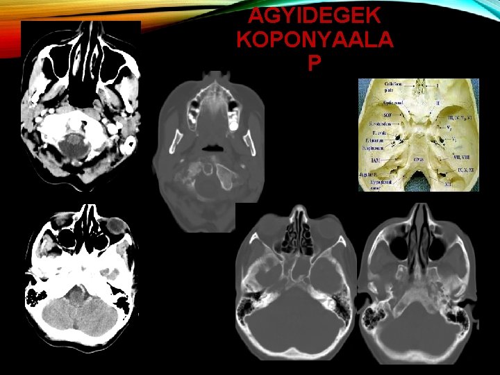 AGYIDEGEK KOPONYAALA P 