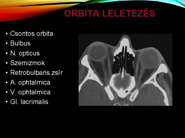 ORBITA LELETEZÉS • • Csontos orbita Bulbus N. opticus Szemizmok Retrobulbaris zsír A. ophtalmica