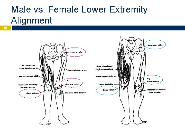 Male vs. Female Lower Extremity Alignment 15 